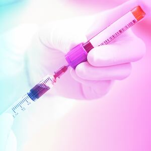 PRFM Injections for Under-eyes Review